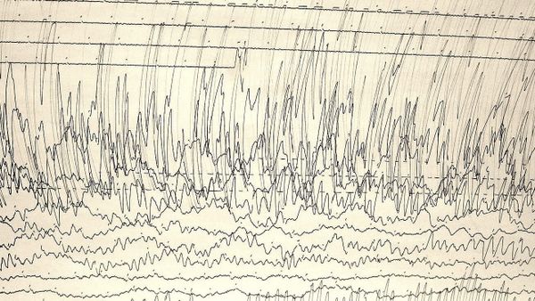 The Loeb Scale for science PR disasters