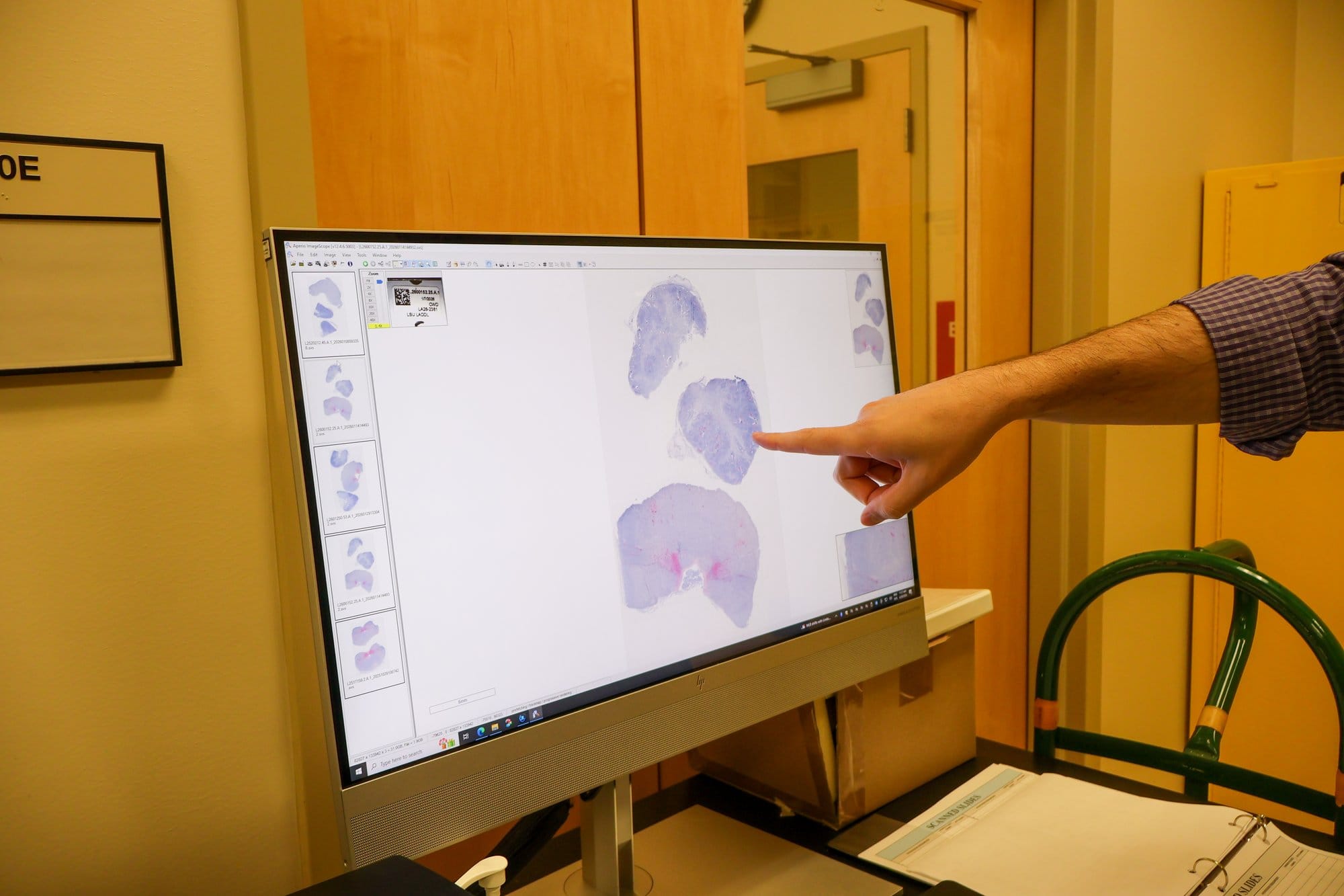 Pathologist Mariano Carossino points out areas in pinkish-red on a computer monitor in the Louisiana Animal Disease