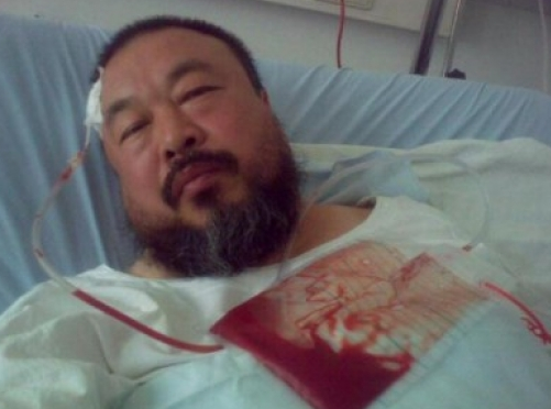Ai Weiwei in hospital