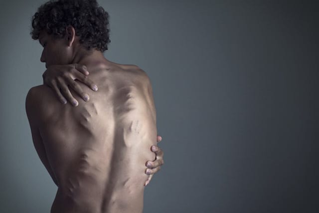 A work by Christian Hopkins, who explains, "I've been suffering from Major Depression for the past 4 years and it has manifested itself throughout that period in many ways, photography included." (via mymodernmet.com)