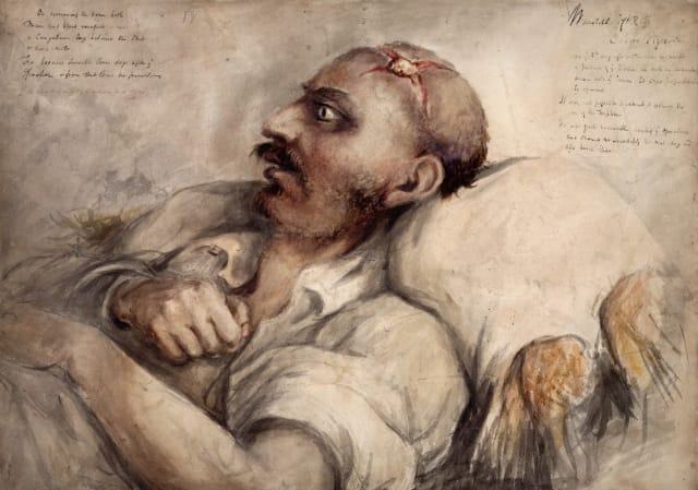 Charles Bell, watercolor of a soldier suffering from a head wound, one of the surgeon's depictions of wounded soldiers from the battle of Waterloo (1815)