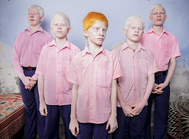 Brent Stirton's photograph of "blind albino boys" in India (courtesy Getty Images & World Press Photo)