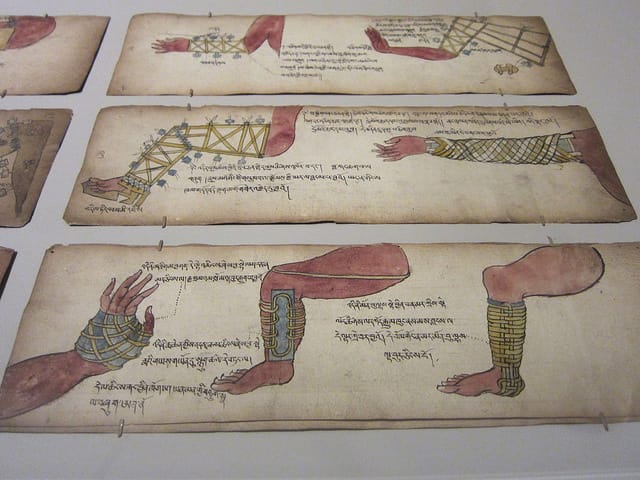 Illustrated bone setting manuscript