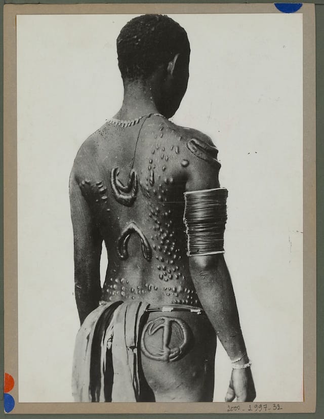 Scarification tattoos on a man in Gasmata, Papua New Guinea (1930-1935) (photograph by Edmond Demaître, © musée du quai Branly)
