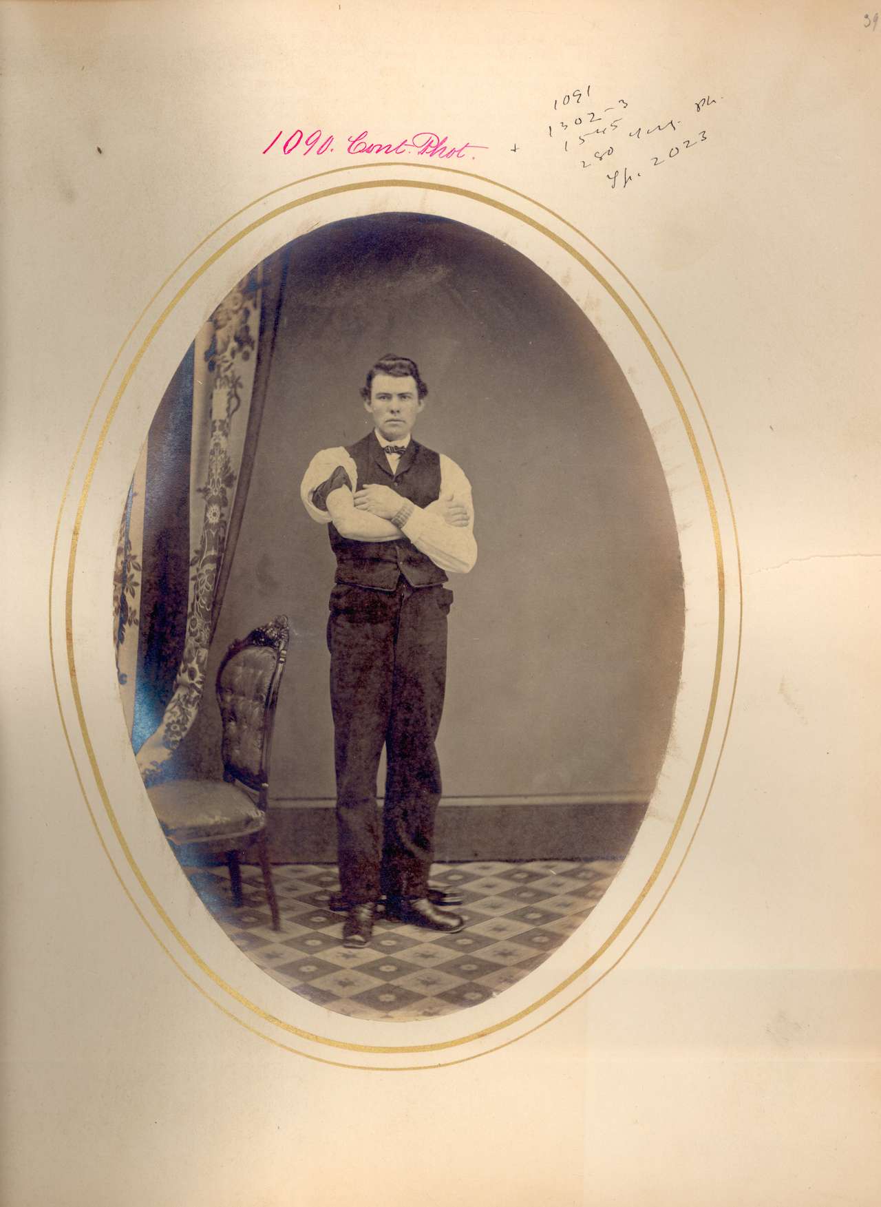 Jacob T. Hertzog. Gunshot wound of right elbow, excision of elbow joint. PVT, Company K, 47th Pennsylvania Volunteers. Wounded October 22, 1862 at the Battle of Pocotaligo, South Carolina. (via National Museum of Health and Medicine)