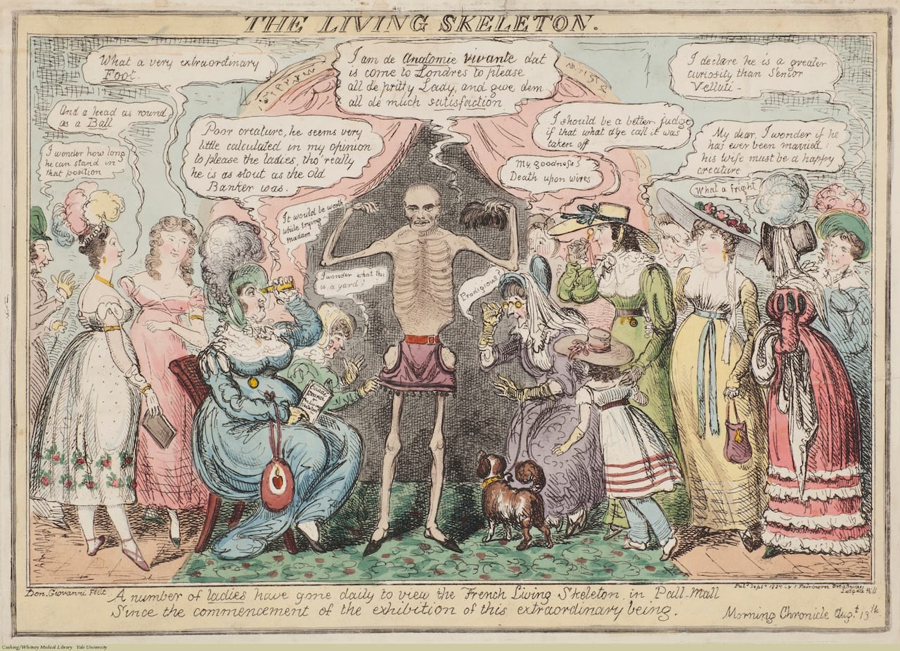 Robert Cruikshank, The Living Skeleton, 1825, etching, hand colored, 24.5 x 34.5 cm (plate), Cushing/ Whitney Medical Library, Collection of Prints and Drawings, Yale University.