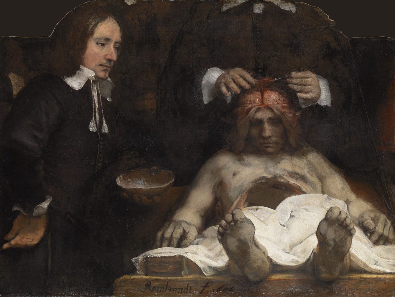 Rembrandt, "The Anatomy Lesson of Dr Joan Deyman" (1656), oil on canvas, 100 x 134 cm (© Amsterdam Museum, SA 7394)