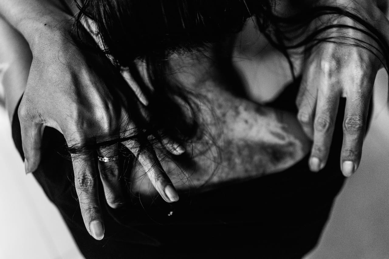 900 square feet of hidden hope. Shirley suffered third-degree burns over much of her back and arms when the mother of her employer placed a pot of boiling soup on top of the shoe rack where the families’ shoes were stored. Bethune House, Hong Kong, August 26, 2014. © Xyza Cruz Bacani. 