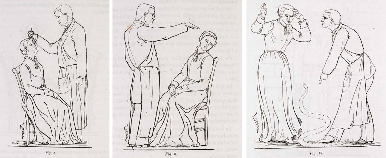 Diagrams of forms of hypnotism, and its effects, 'Iconographie photographique de la Salpêtrière' (1876-80) by D.M. Bourneville and P. Regnard 