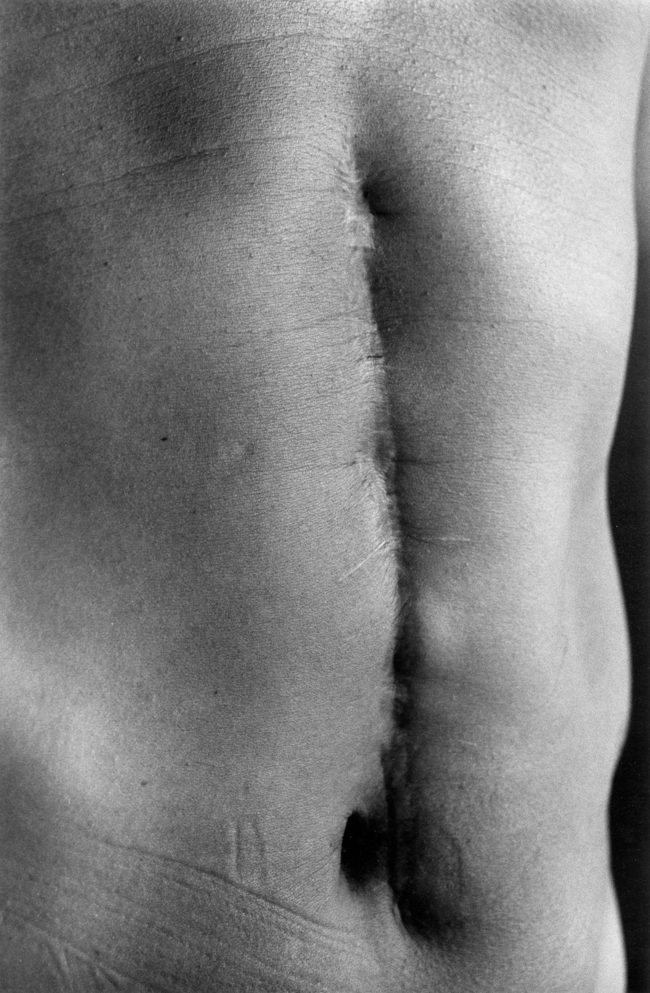 Ishiuchi Miyako, “Scars #27 (Illness 1977)” (1999) (courtesy the artist and the National Museum of Modern Art, Tokyo)