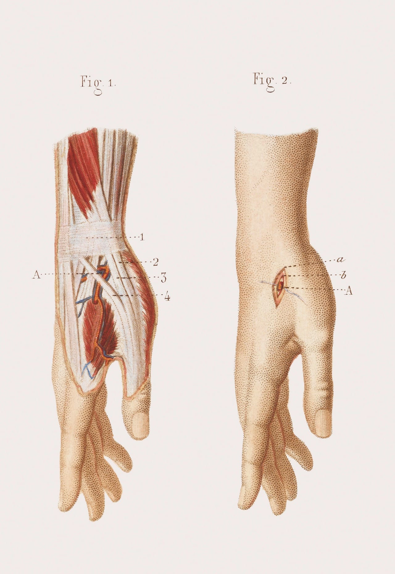 Credit: Wellcome Library, London. Wellcome Images