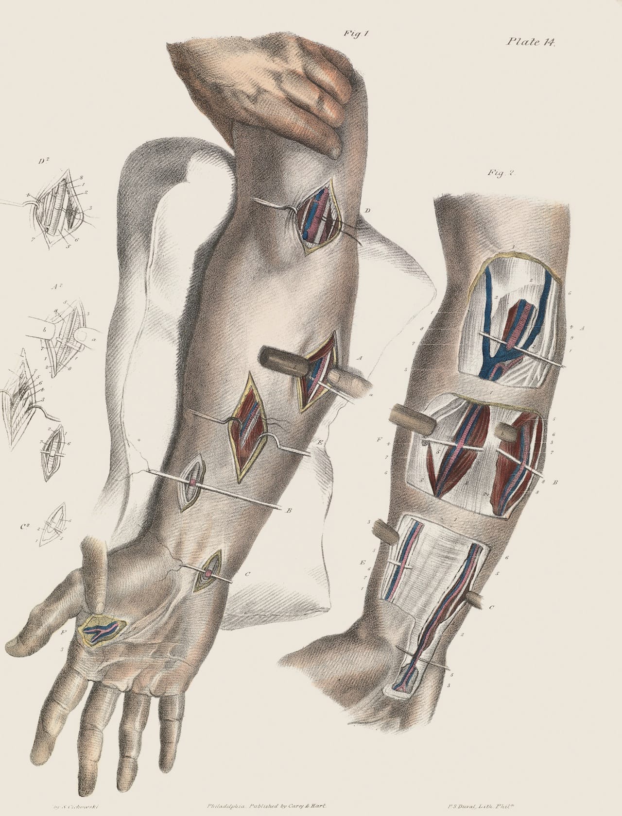 Credit: Wellcome Library, London. Wellcome Images