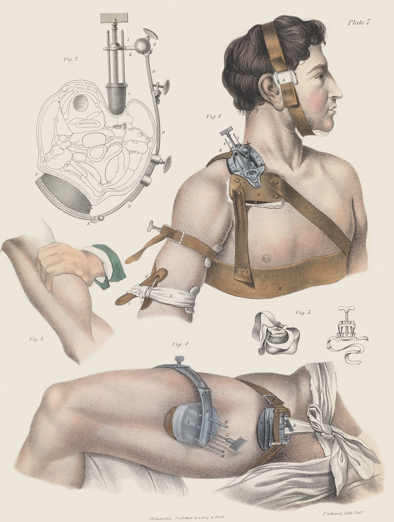 Credit: Wellcome Library, London. Wellcome Images