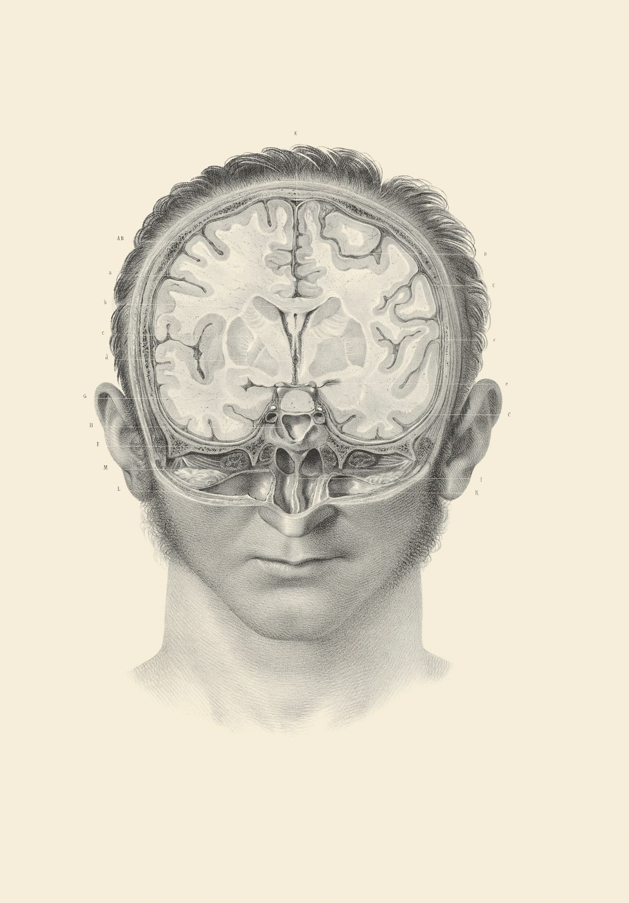 Credit: Wellcome Library, London. Wellcome Images