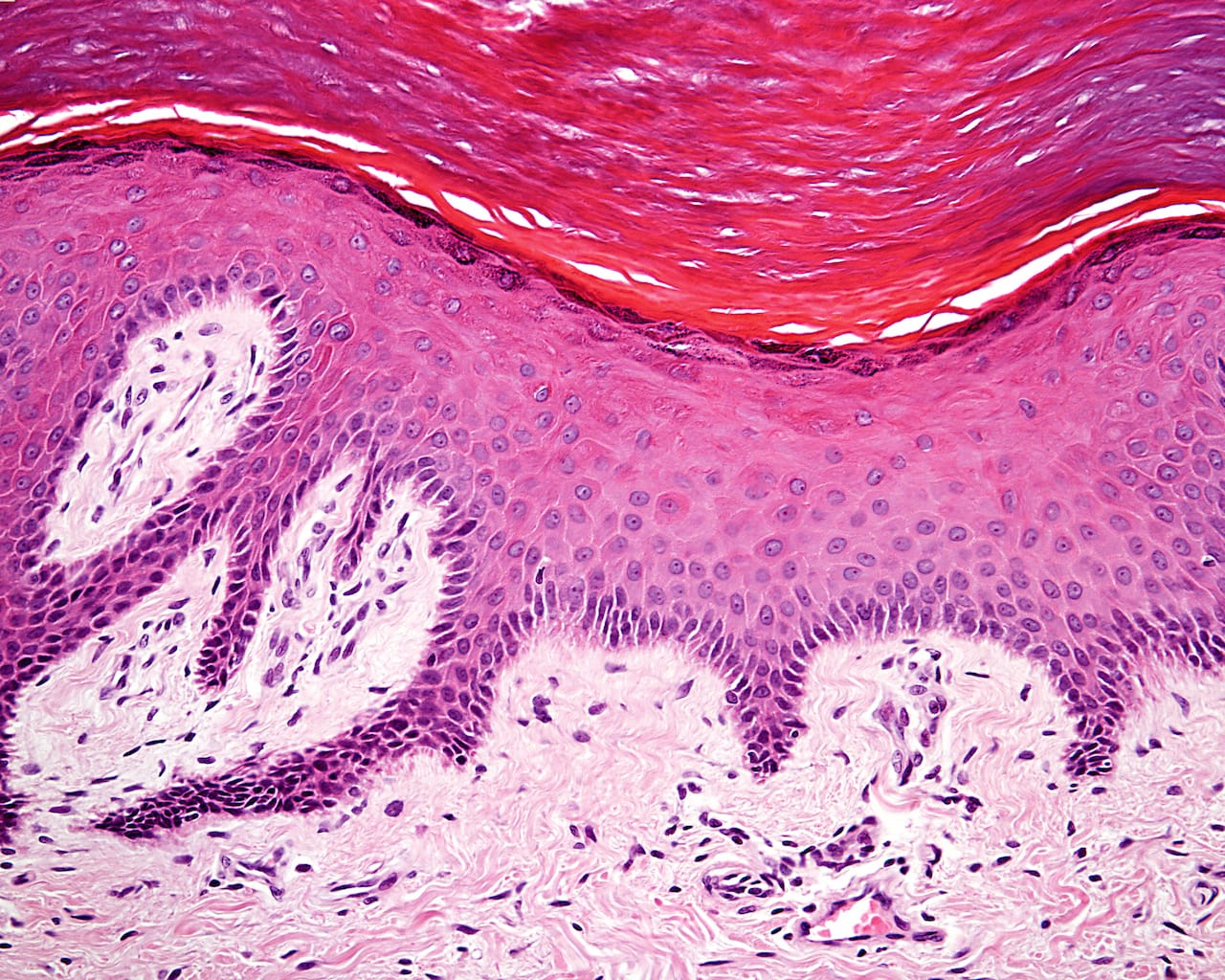 P 120 A Epidermis and Dermis of the Skin of a Finger