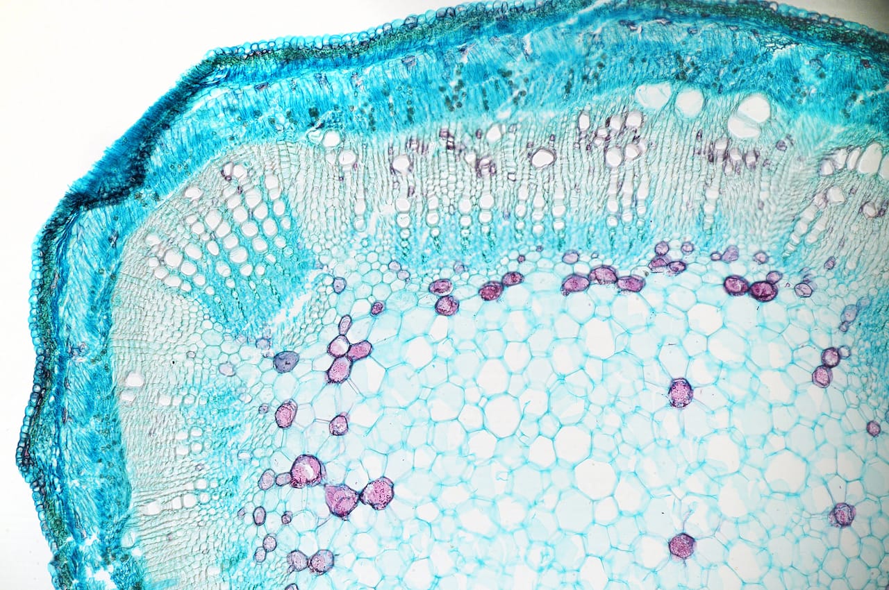 P 120 F Section of a Cotton Stem