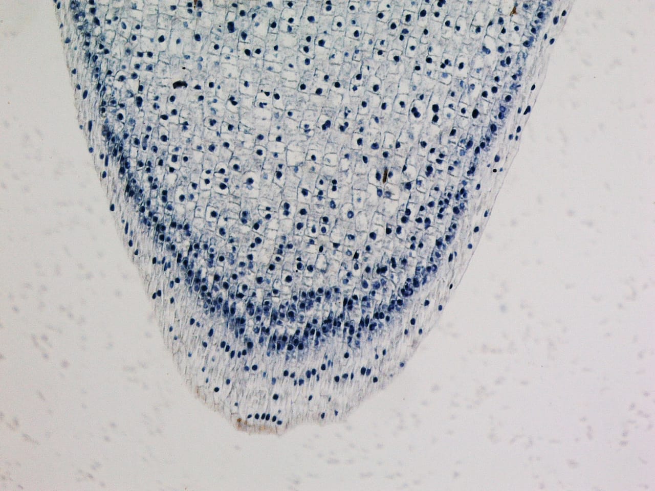  Light micrograph showing a corn root tip