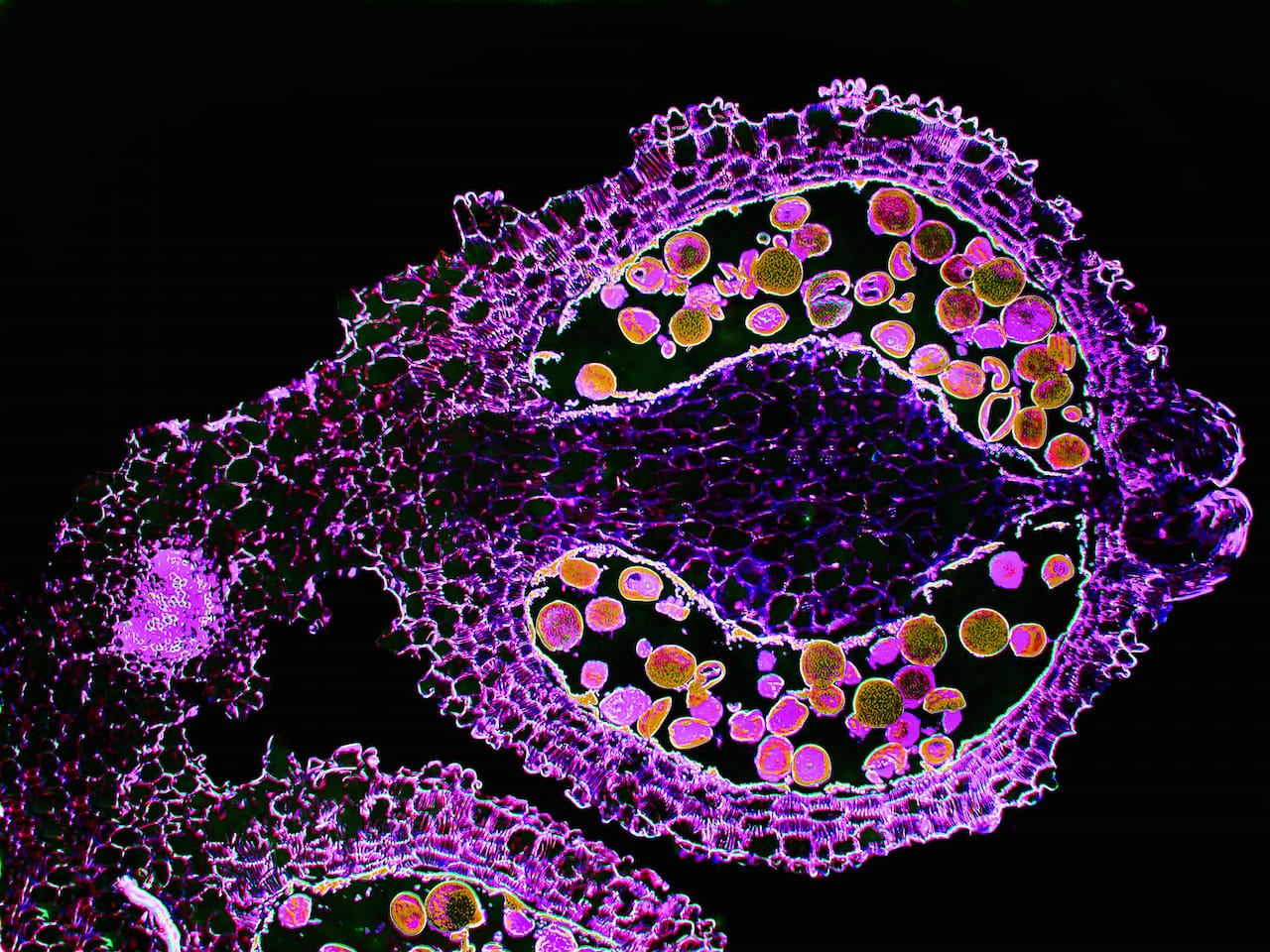 P 77 Enhanced light micrograph of pollen grains