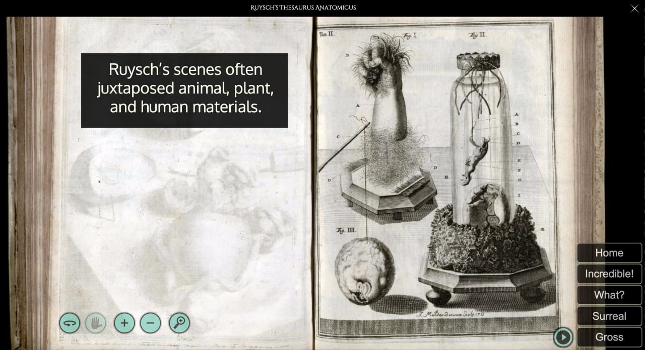 Frederik Ruysch's 'Thesaurus anatomicus primus' on Memento Mütter (screenshot by the author for Hyperallergic)