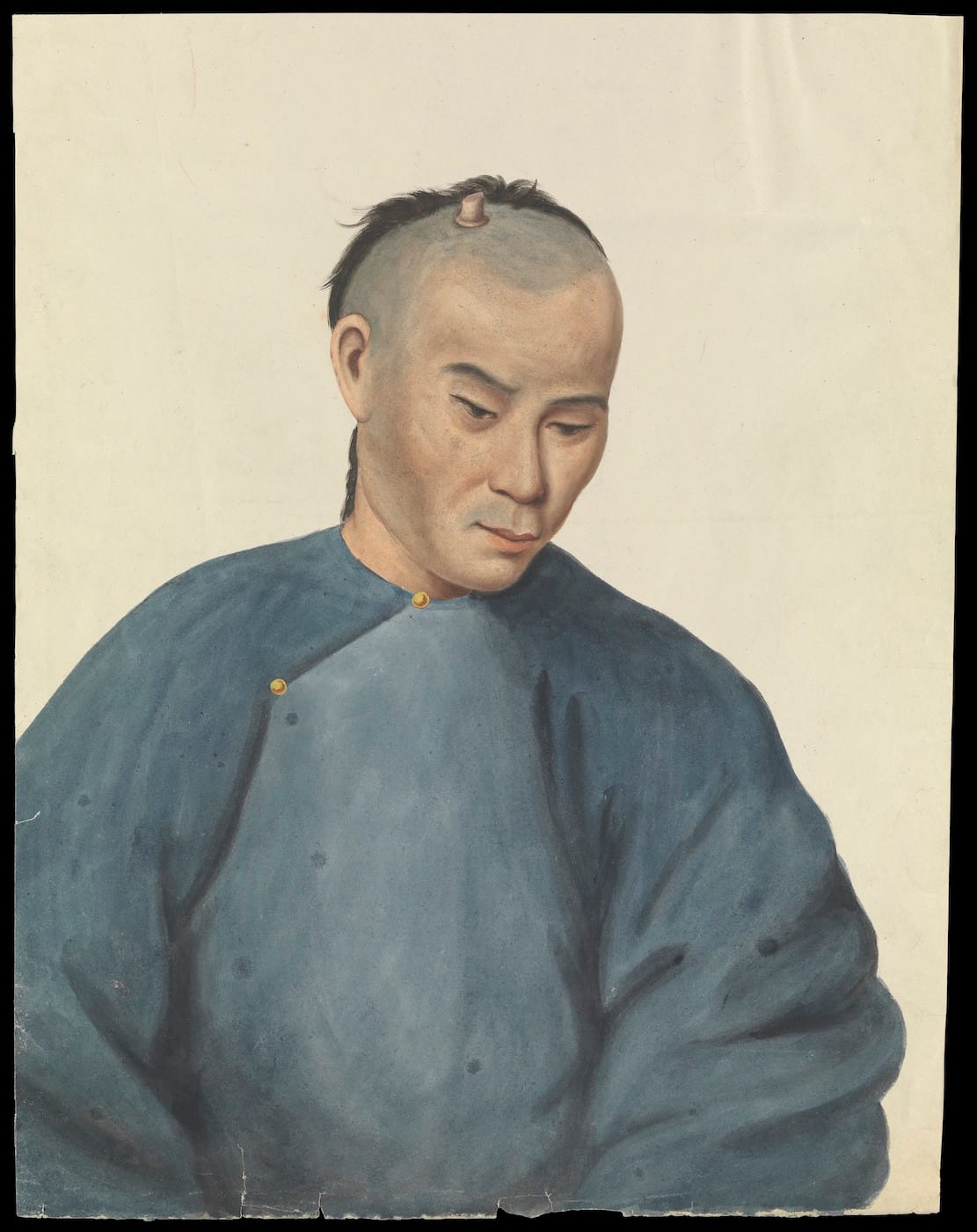 Guan Qiaochang Lamqua, "A man with a cutaneous horn-like growth on the scalp" (via Wellcome Images/Wikimedia)