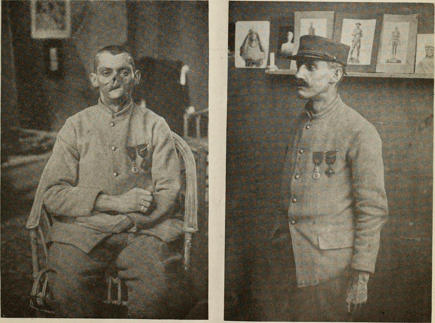 Before and after photographs of a soldier with a mask sculpted by Anna Coleman Ladd (1918) (via Internet Archive Book Images/Flickr)