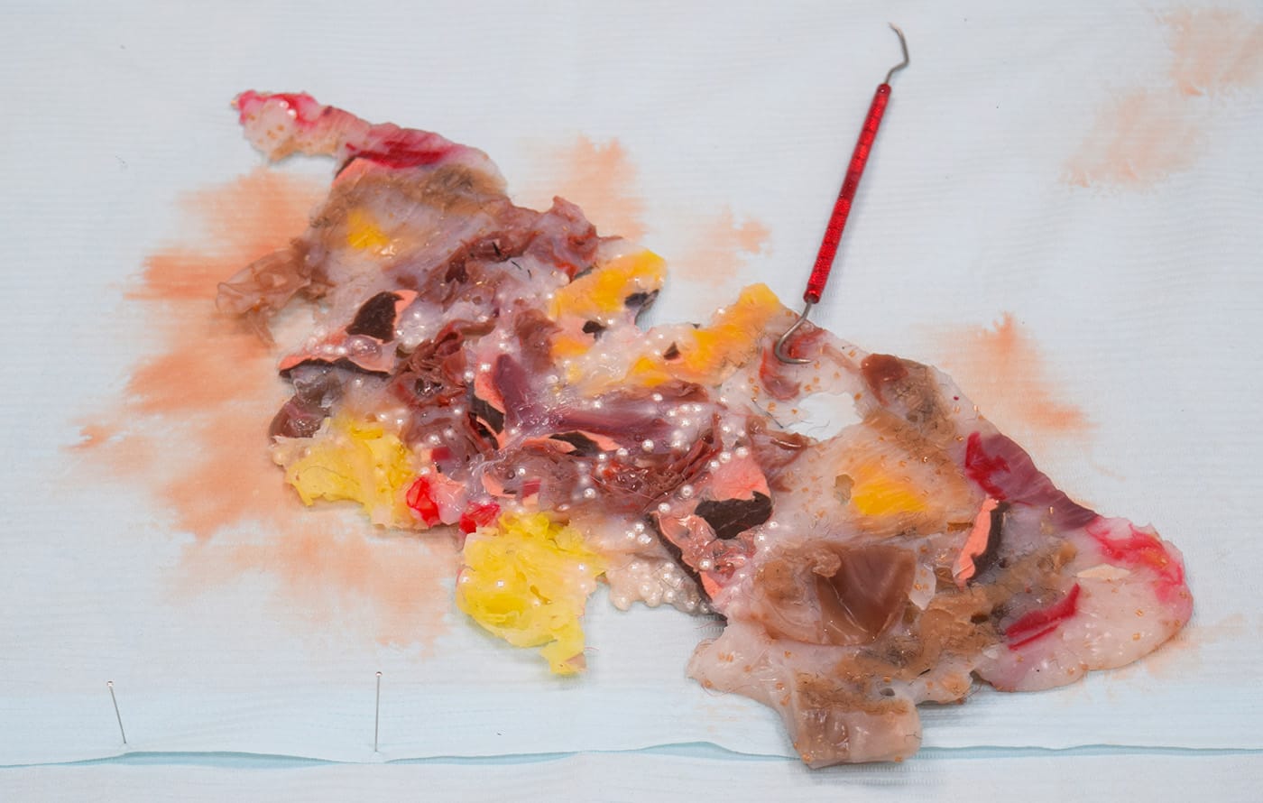 Doreen Garner, "Flora: Viscera" (2016, detail), silicone and mixed media, dimensions variable