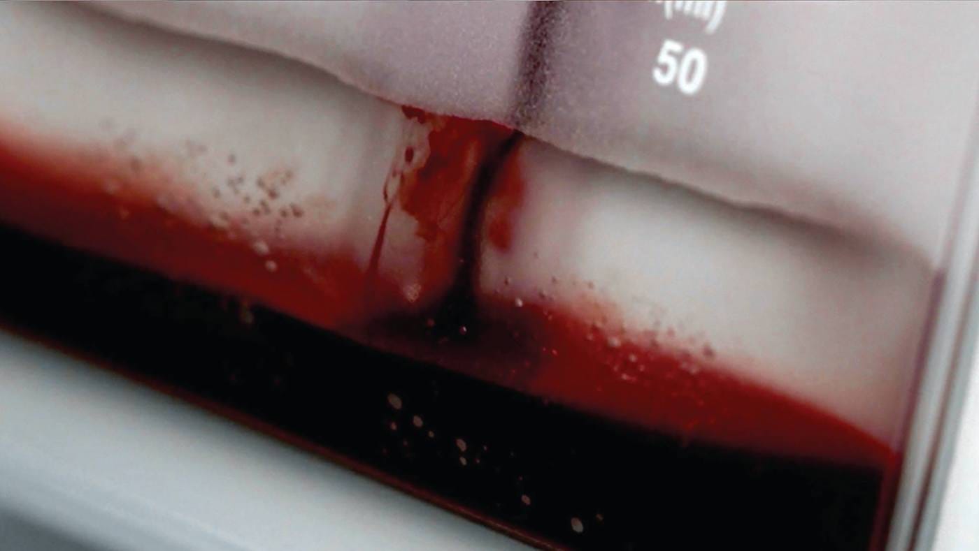 Blood Equality photo by Jordan Eagles (via facebook)