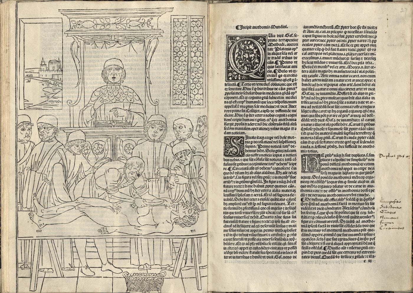 Illustration of a dissection in <em>Fasciculus Medicinae</em> (first published 1491, edition from 1495) (courtesy the New York Academy of Medicine)