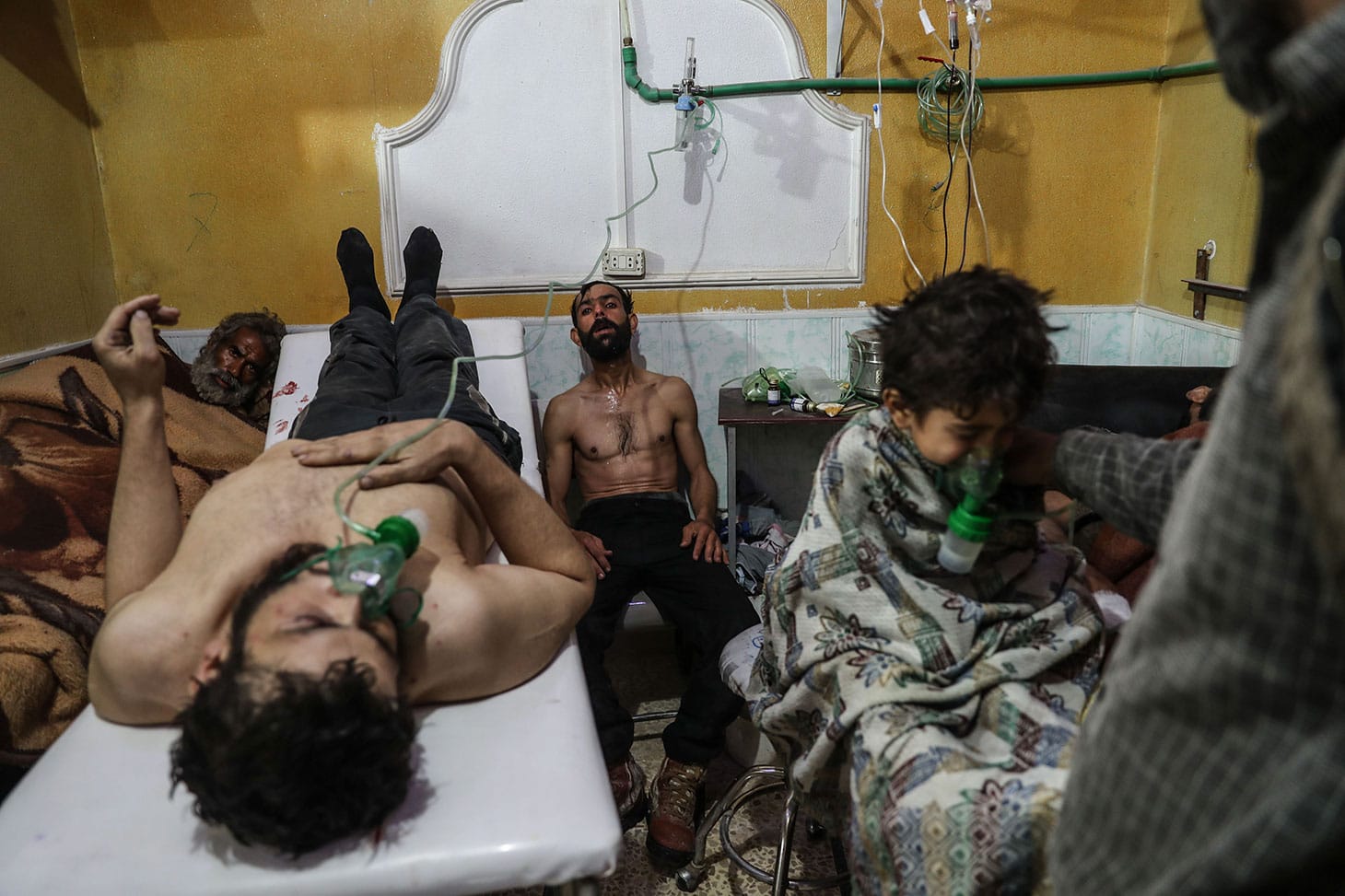 Mohammed Badra, :Victims of an Alleged Gas Attack Receive Treatment in Eastern Ghouta" (2018): A man and a child receive treatment after the suspected gas attack on al-Shifunieh, February 25, 2018 (© Mohammed Badra, European Pressphoto Agency)