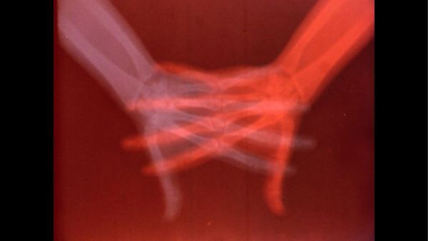 Medical Imaging and Art Meet in the Exhibition “Overexposed”