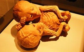 Medical Museum Invites Artists in to Probe Illness