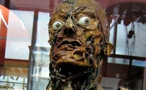 Early Anatomical Specimens Model the Macabre