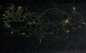 Two Beings Collaborate on Art, One a Human, Another a Slime Mold