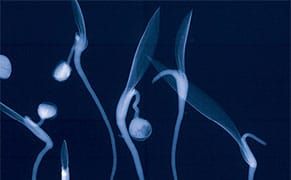 Archiving Eden Ahead of the Apocalypse