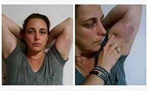 Artist Tania Bruguera Arrested Again in Havana, Injured by Police