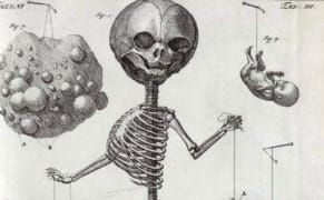 The 18th-Century Anatomist Who Celebrated Life with Dioramas of Death