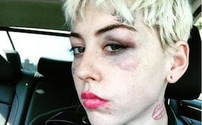 Trump Supporter Punches Artist of Micropenis Drawing