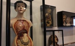 The Challenges of Showing the Artifacts of an Early European Wax Museum Today