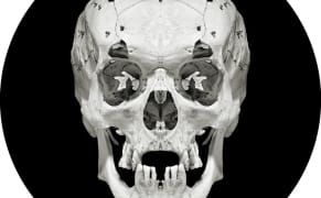 Creating a Skeletal Symmetry from a 19th-Century Collection of Imperfect Skulls