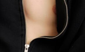 Fragmented Figures Channel the “Struggle of Being in a Body”