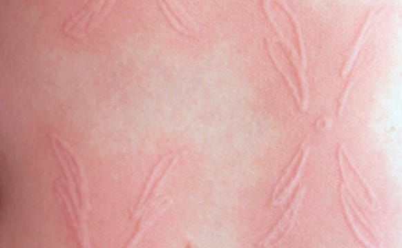 Artists Show What It’s Like to Live in Your Own Skin