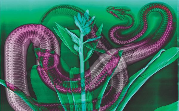 Considering the Clarity of X-ray Photography