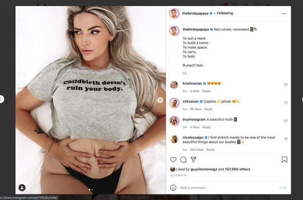 An Antidote to Instagram’s Toxicity Is Already in Our Hands