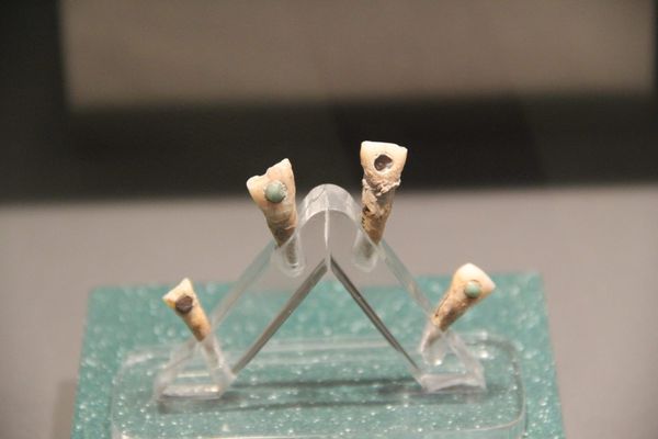 The Very Expensive Dental Work of the Ancient Maya