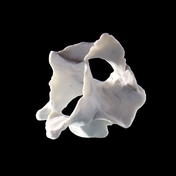 A Body of Work Inspired by One Hip Replacement