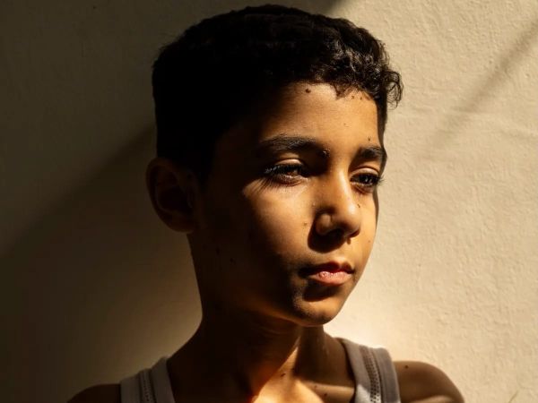 Devastating Photo of Gaza Child Amputee Wins Top Global Award