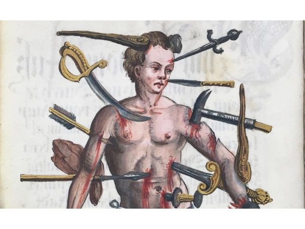 How the Wound Man Healed Medieval Europe