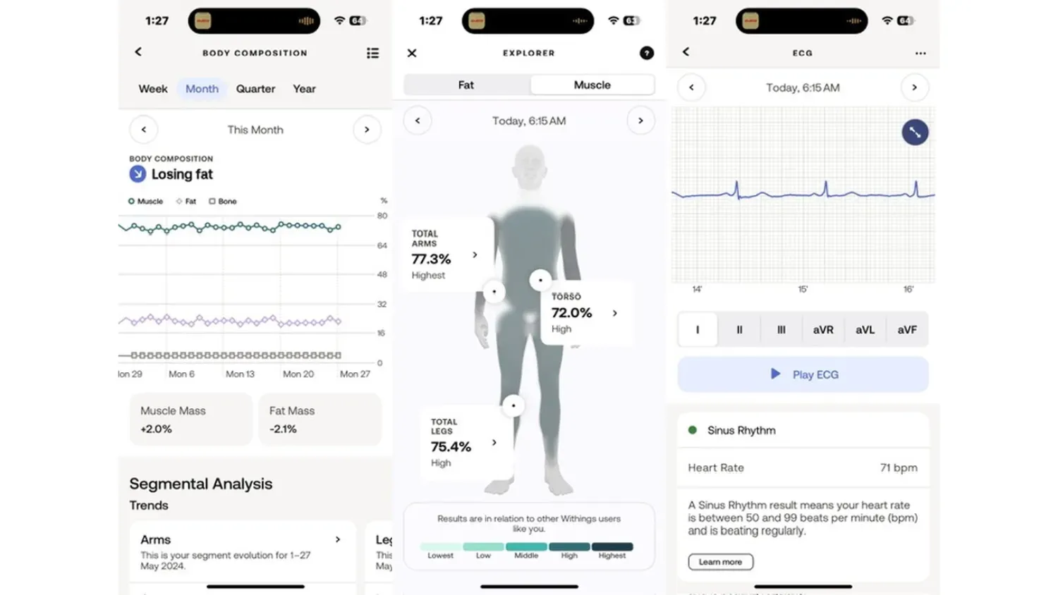 Screenshots from the Withings app