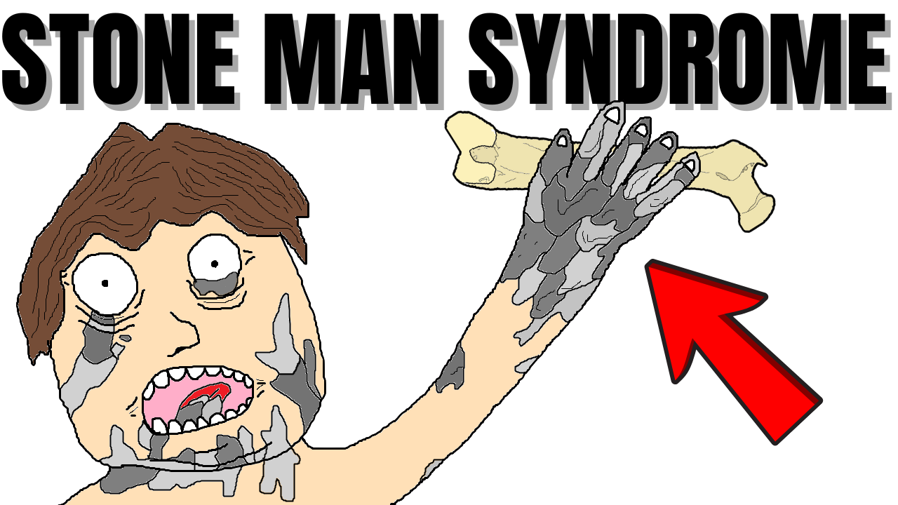 Disease That Turns Your Body Into Stone