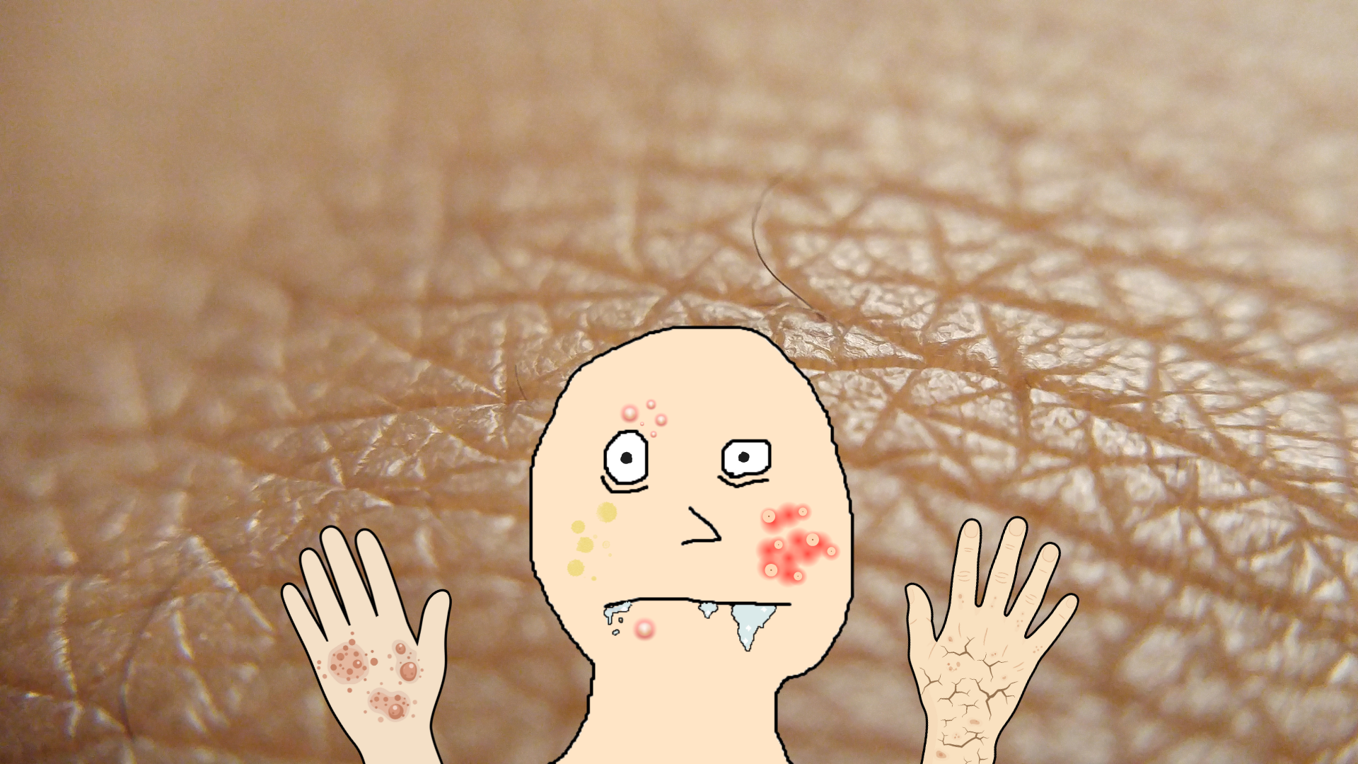 Why I won’t specialize in dermatology?